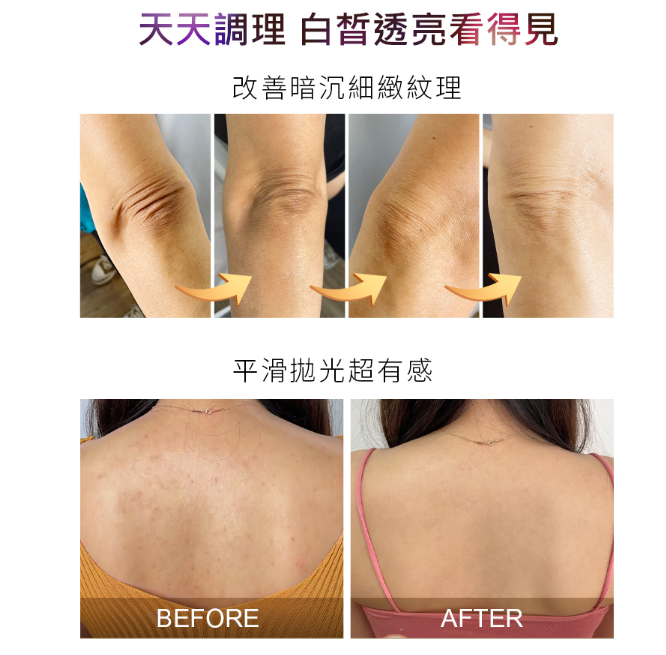 2%水楊酸美白身體乳 120ml