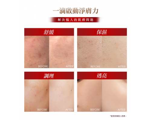 76酵母胺基酸淨膚潔顏露（防滑升級版）150g