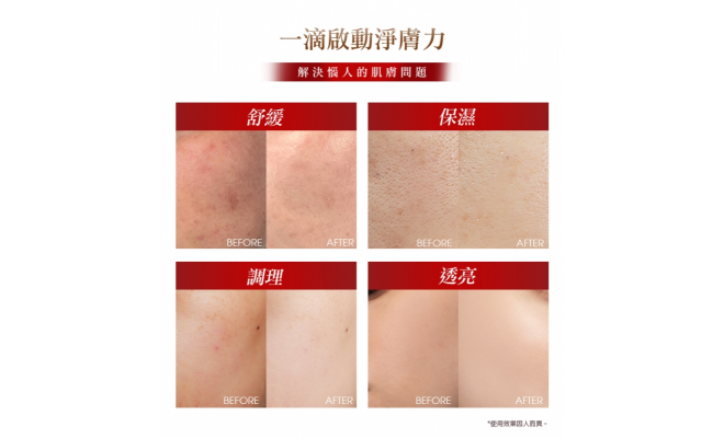 76酵母胺基酸淨膚潔顏露（防滑升級版）150g