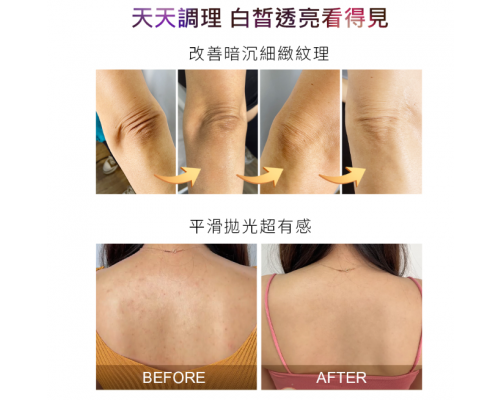 2%水楊酸美白身體乳 120ml