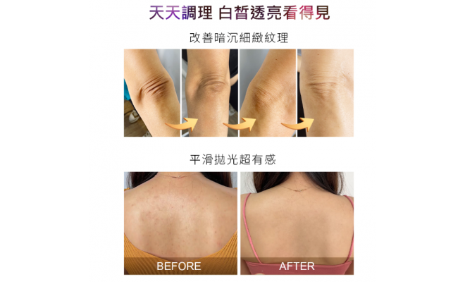 2%水楊酸美白身體乳 120ml
